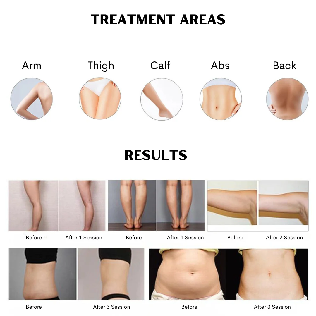 Elora 12D Diode Lipo Laser Weight Loss Machine - Image 3