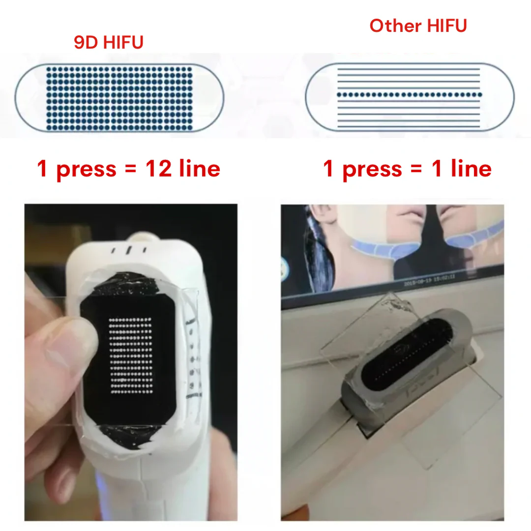Rejuva 9D Face Lifting HIFU Machine - Image 11