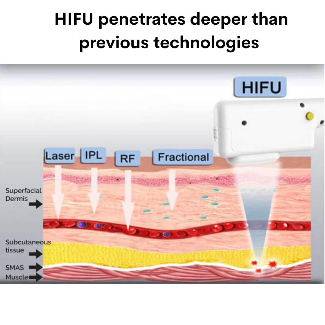 Rejuva 9D Face Lifting HIFU Machine - Image 5