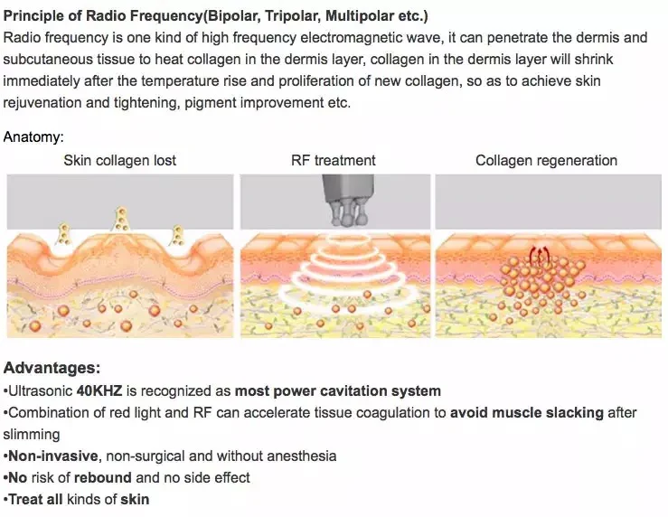 Marla 6 in 1 Cavitation Machine - Image 9