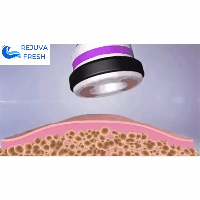 Adonis™ 9 in 1 Cavitation Machine for Toning & Slimming - Image 8