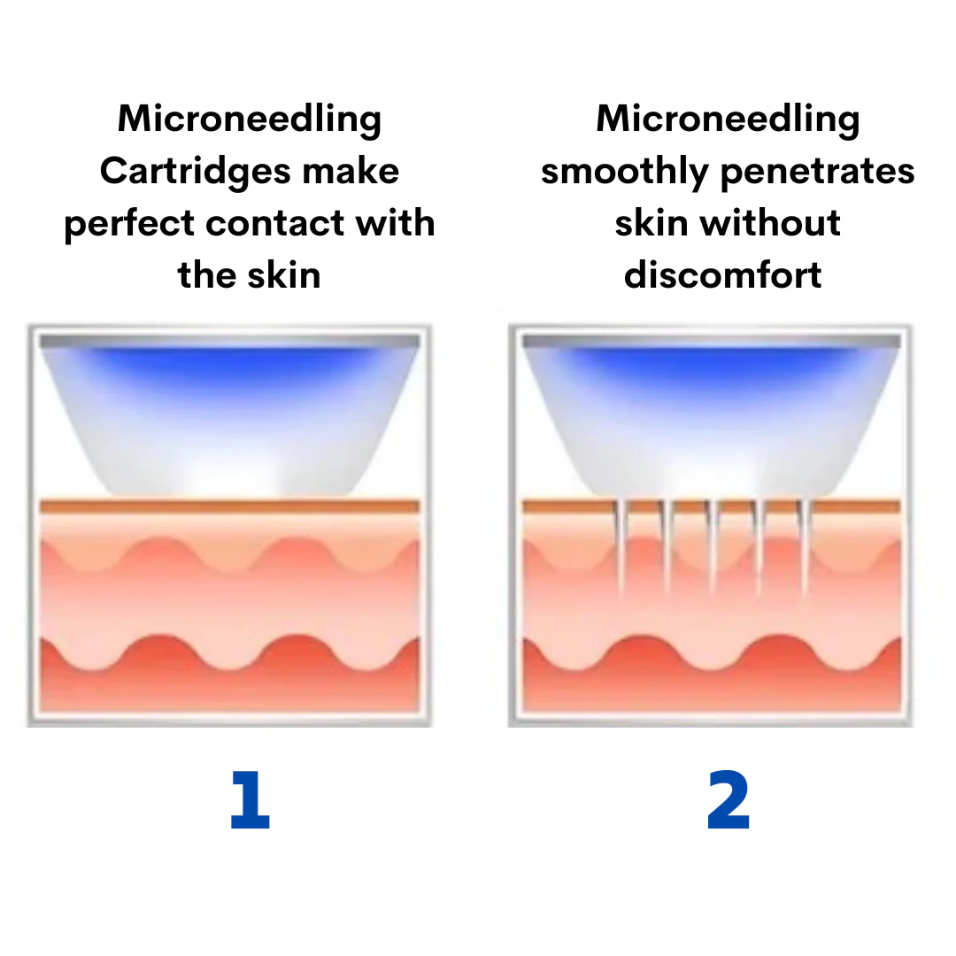 Beauty Disruptor™ RF Microneedling Machine 3 in 1 - Image 4