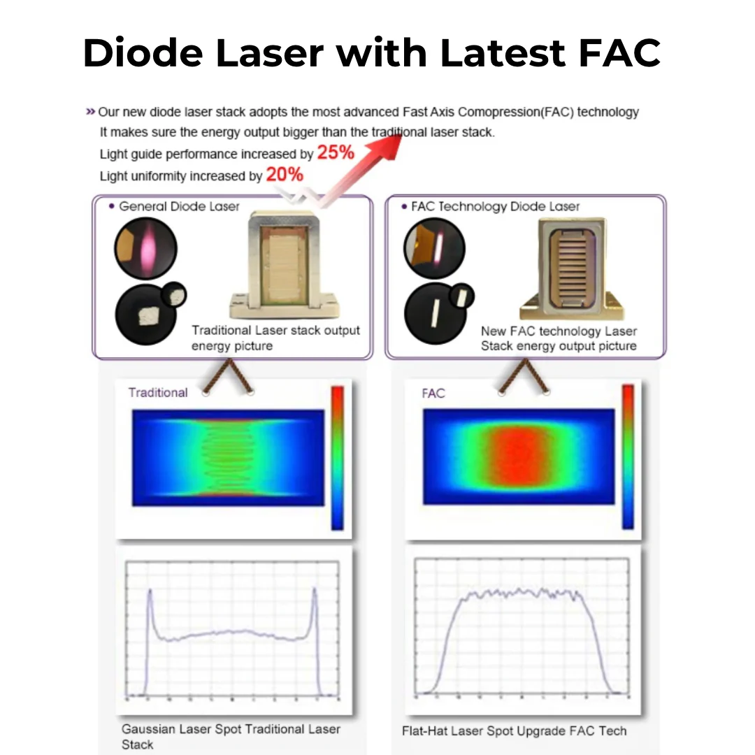DuoSmooth™ 2-in-1 Diode Laser + IPL System - Image 9