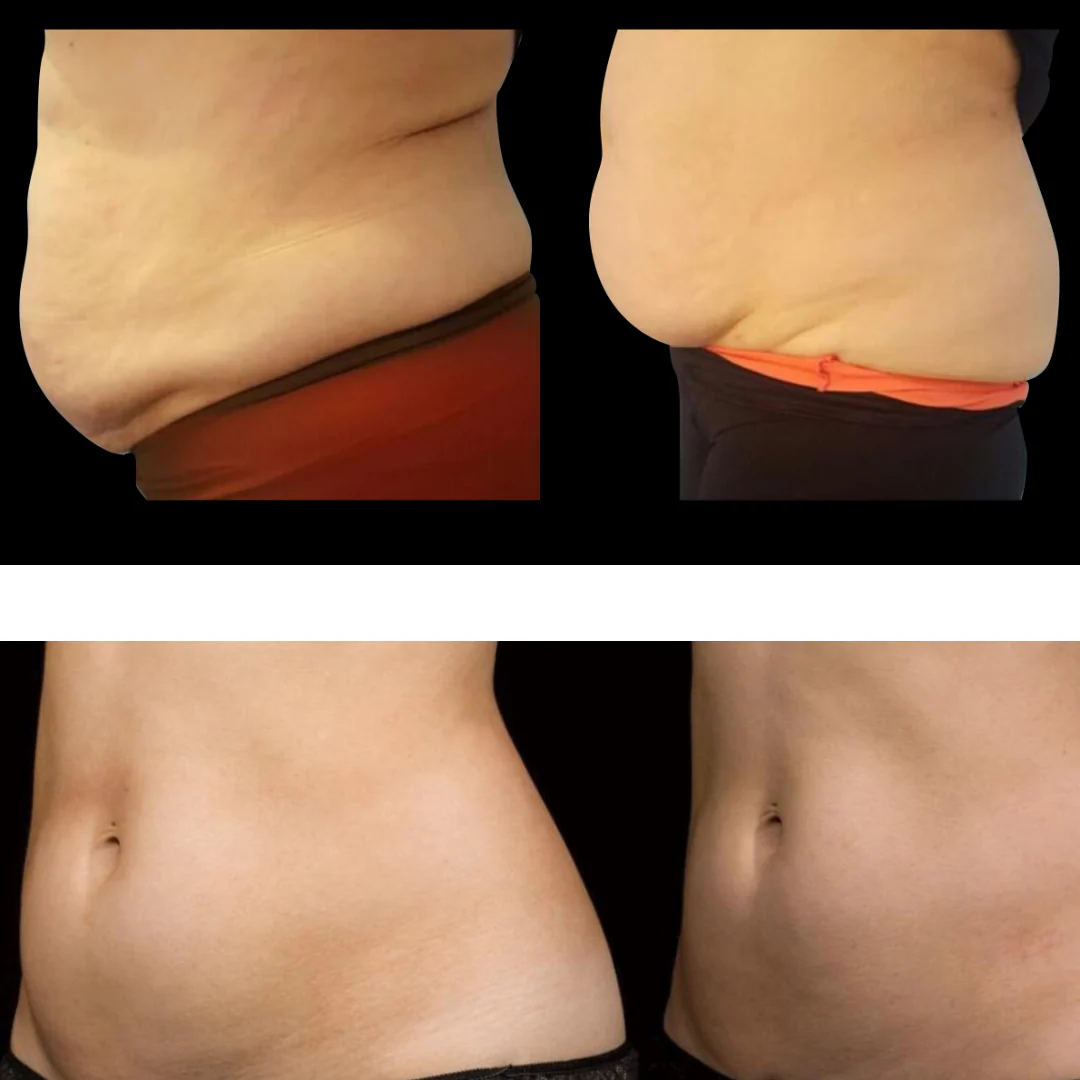 Eris® Lipo Cavitation Machine 9 in 1 Professional - Image 16