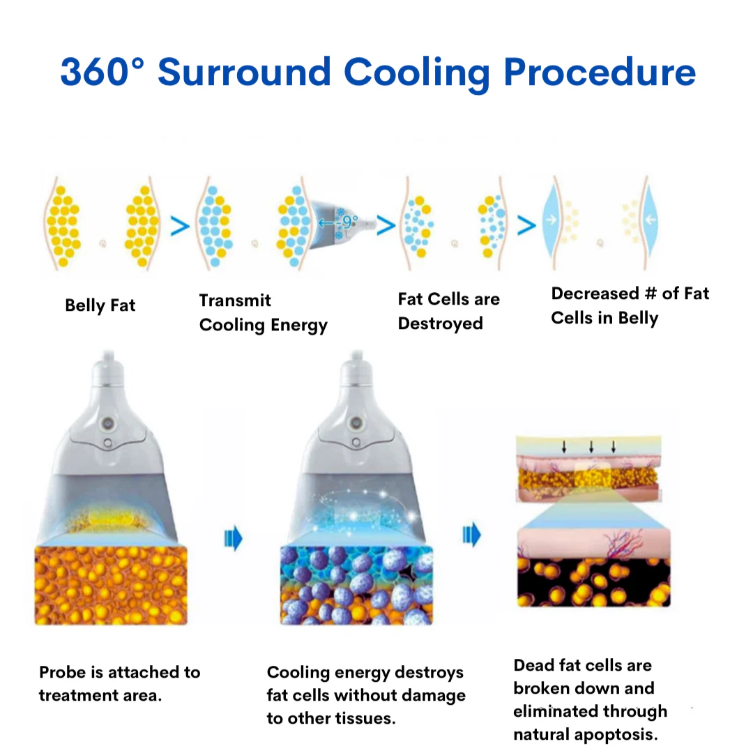 Freezing Attachment for 360 Degrees Cryo Machine - Image 12