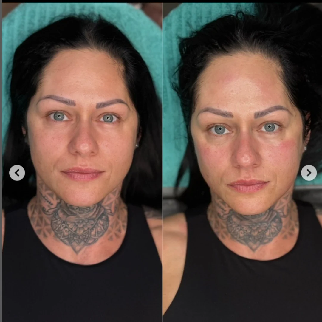 Professional PERFECT FACE™ NEO Skin Ultra 7D - Image 15