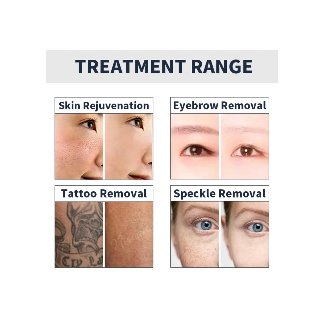 PicoElim™ Pico Laser Tattoo Removal Machine - Image 5
