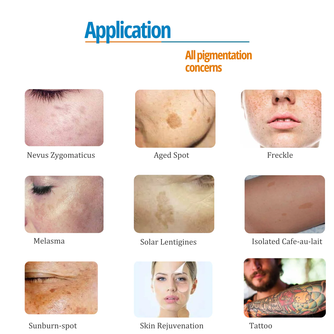 PicoPretty® Picosecond Laser Pigment Solution 750 - Image 2