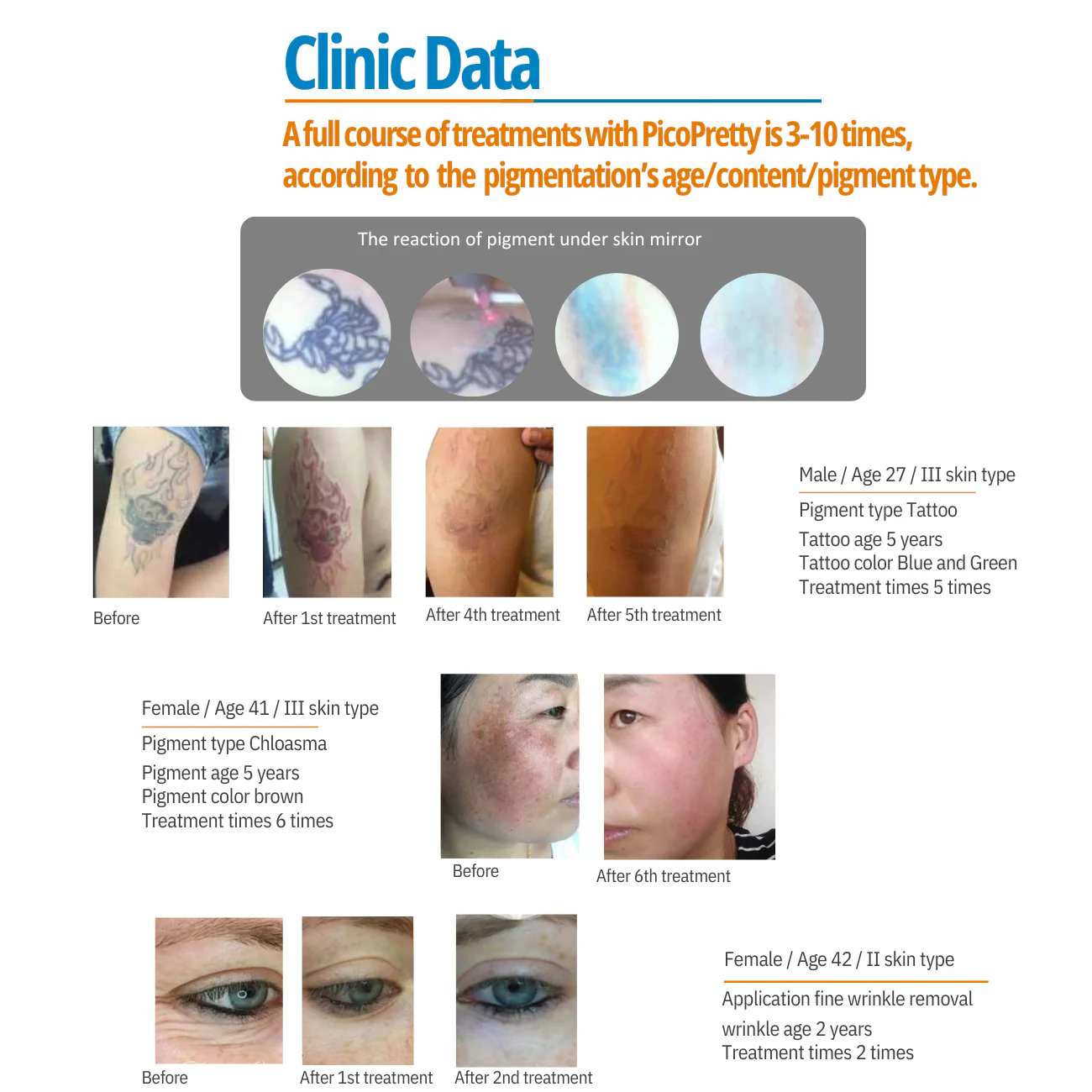 PicoPretty® Picosecond Laser Pigment Solution 750 - Image 4