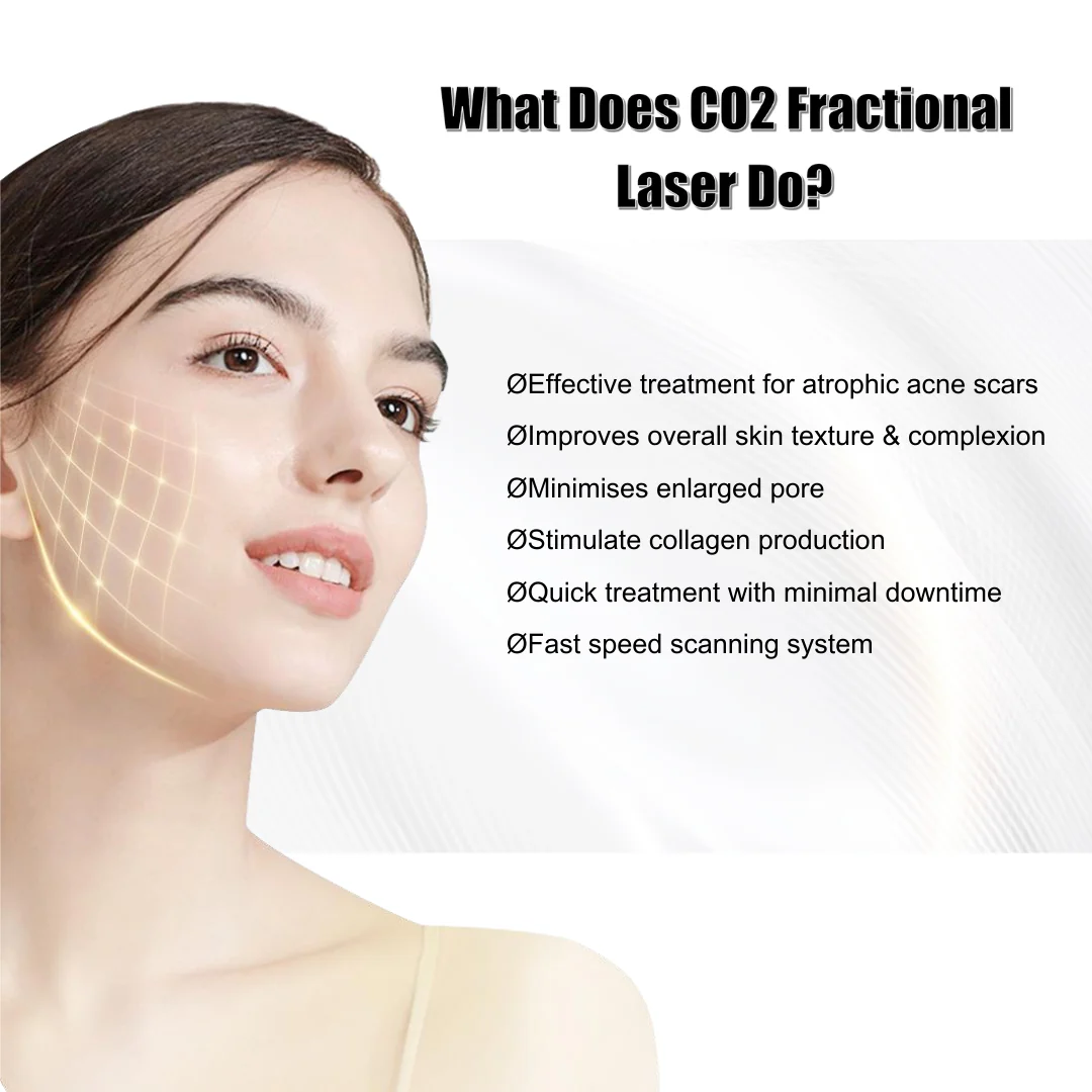 Reveal™ PRO SuperPulse CO2 Laser (80W, Digital) - Image 10