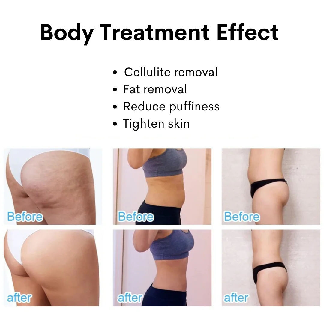 SlimSphere Roller Therapy Body Sculpt Machine (Toning + Cellulite Removal) - Image 10