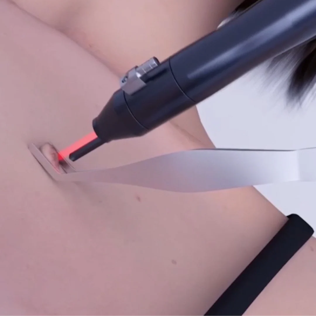 CarbonFrax™  Pro CO2 Fractional Laser - Image 8