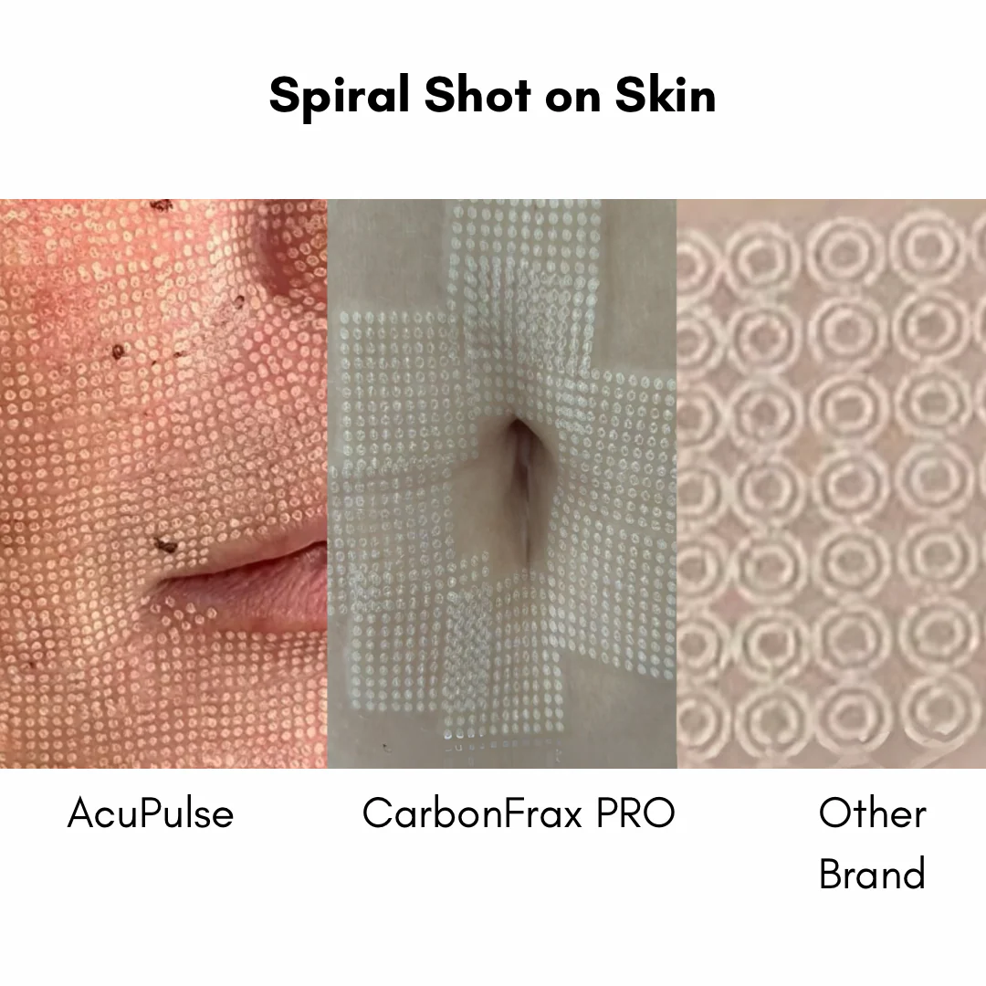 CarbonFrax™  Pro CO2 Fractional Laser - Image 14