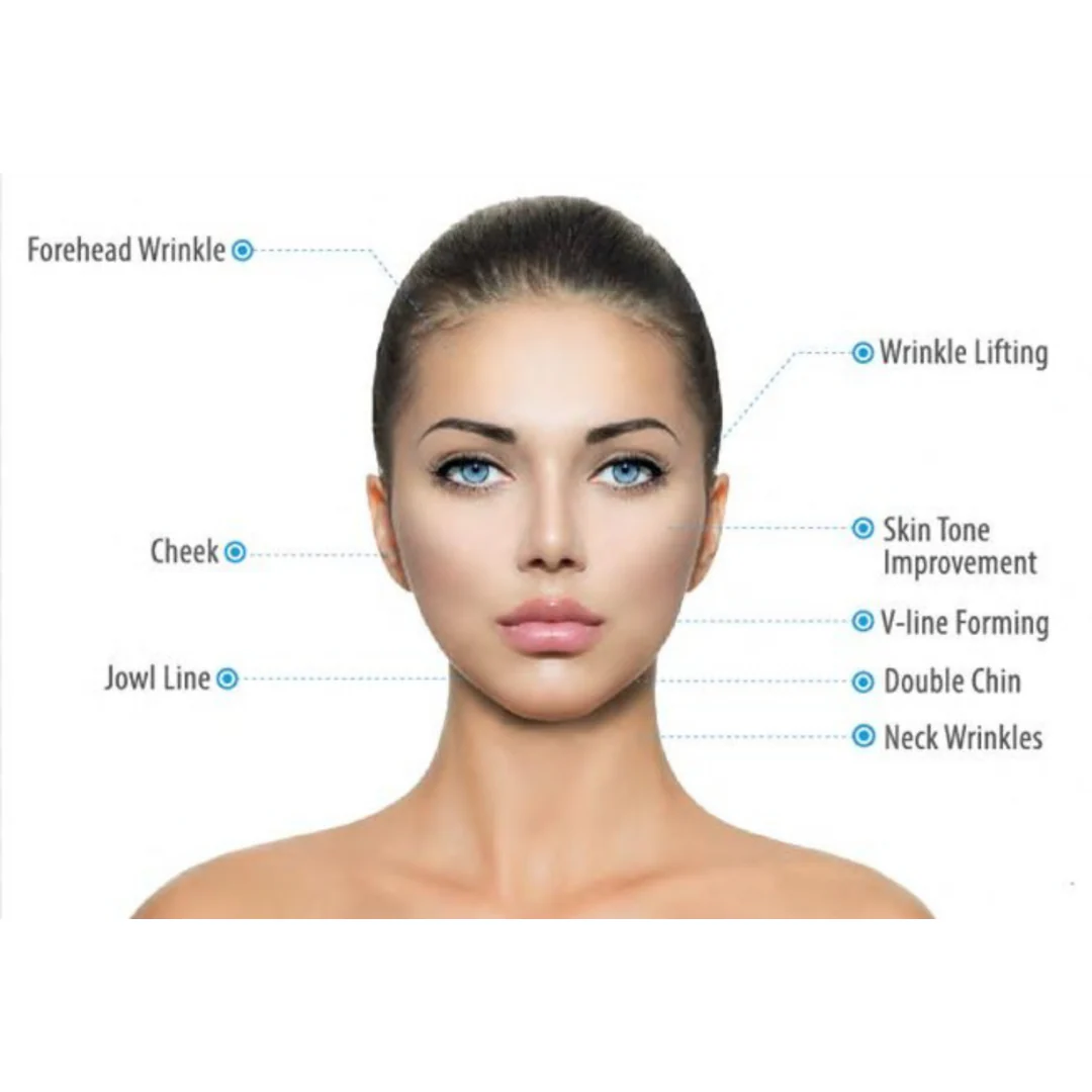 SMAS Prime Focus Professional HIFU Machine for Body & Face - Image 8