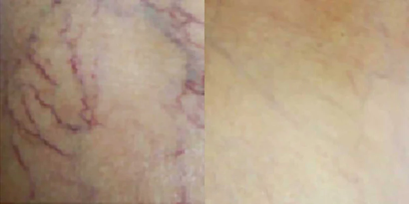 Optimal Skin Resurfacing Power Trio - Image 13