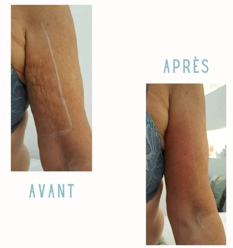 Optimal Skin Resurfacing Power Trio - Image 7