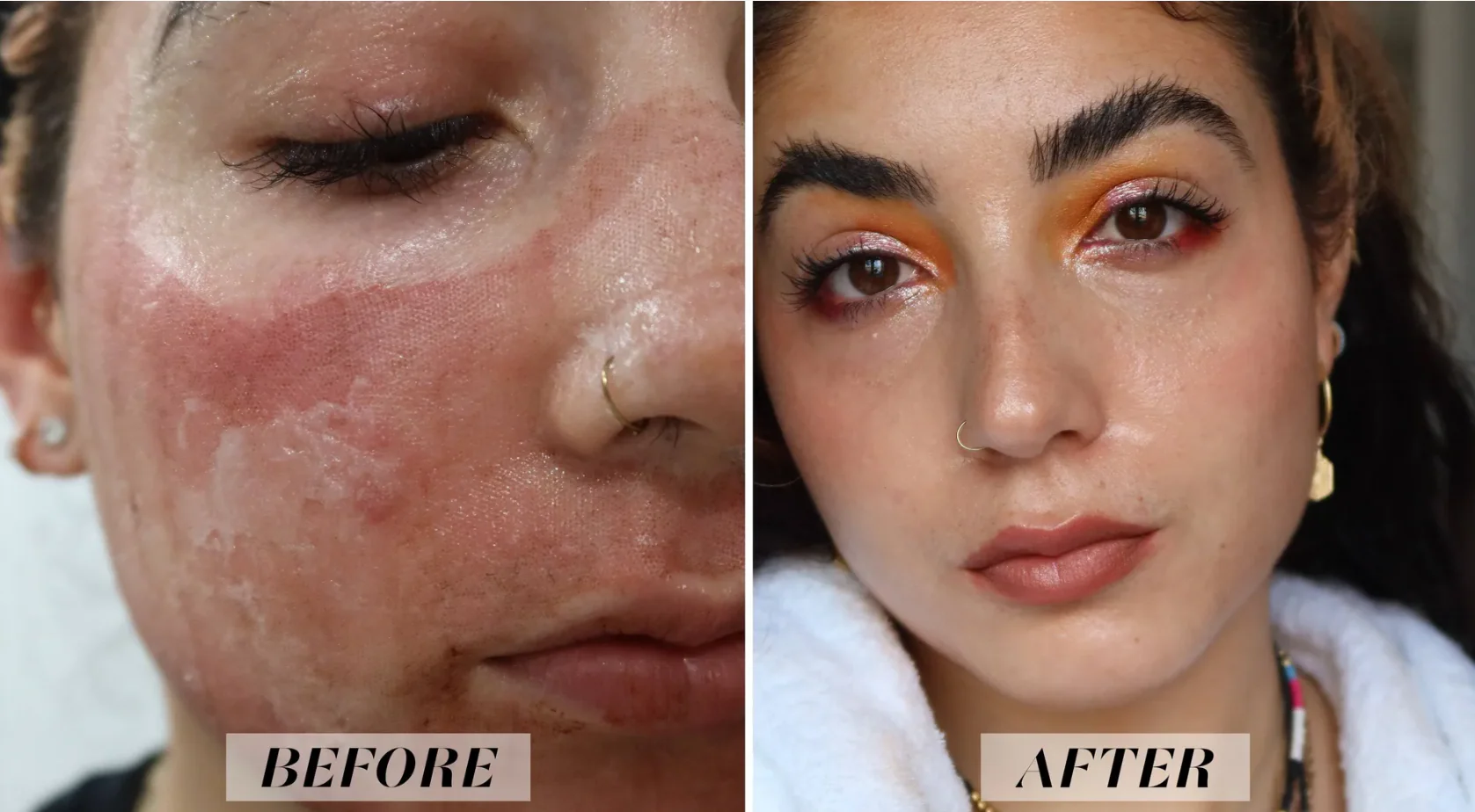 Optimal Skin Resurfacing Power Trio - Image 8